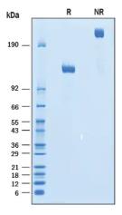 SDS-PAGE (ERBB2-051H).jpg